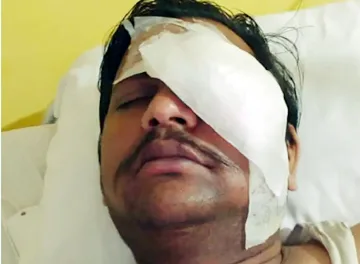 उज्जैन की पार्श्वनाथ सिटी में सनसनी: चोरी रोकने गए RSS पदाधिकारी पर बदमाशों का प्राणघातक हमला